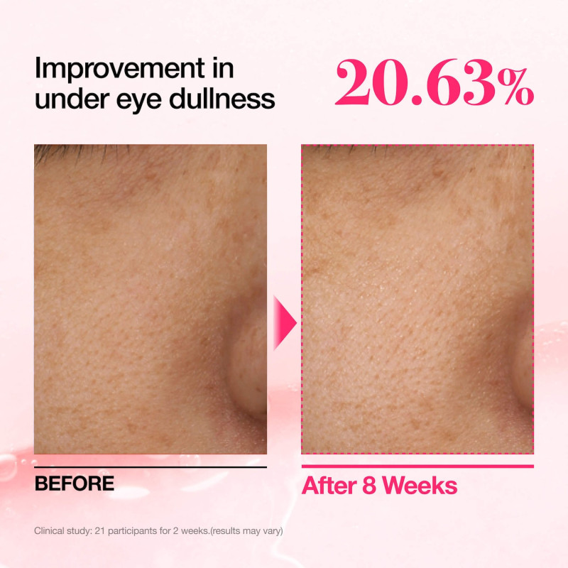 Освітлюючі педи з ніацинамідом 5% та транексамовою кислотою Anua Niacinamide 5 TXA Brightening Pad 210ml (60 штук)
