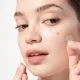 Патчі проти прищів з кислотами Anua Triple Acid Spot Care Microdart Patch (12 шт)