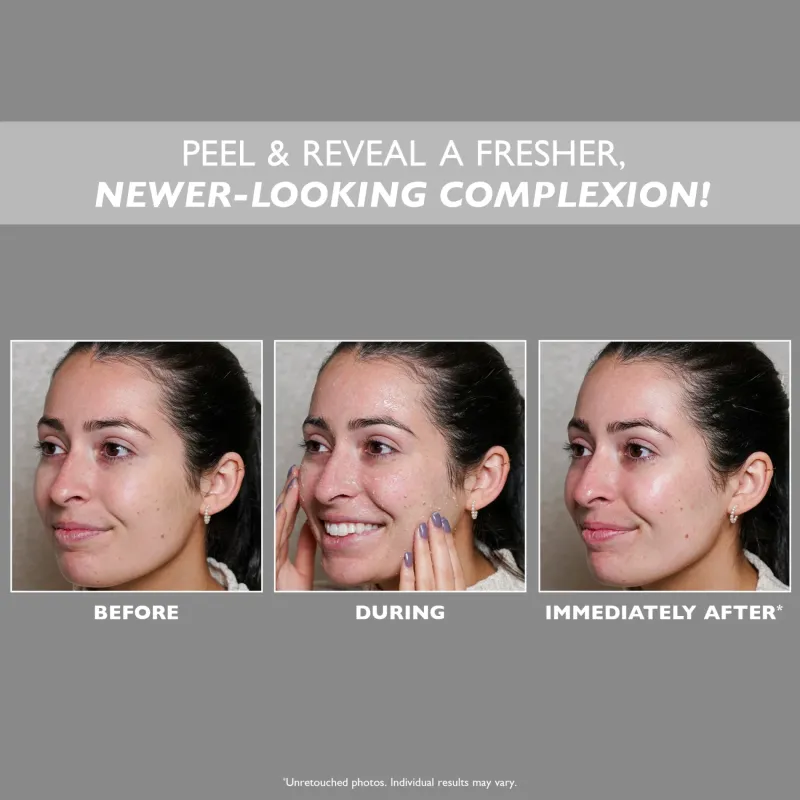 Очищающий пилинг для лица Peter Thomas Roth FIRMx® Peeling Gel 30 ml