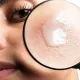 Освітлююча сироватка Allies of Skin Azelaic & Kojic Advanced Clarifying Serum 30 ml