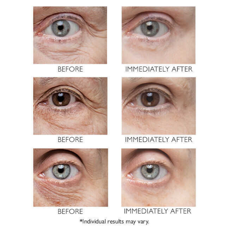 Крем для разглаживания кожи вокруг глаз Peter Thomas Roth Instant FIRMx® Eye Temporary Eye Tightener 30 ml