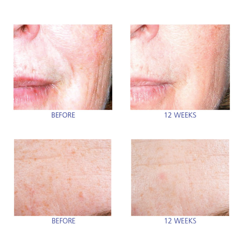 Многофункциональная сыворотка для лица iS Clinical Active Serum 30 ml