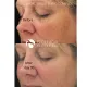 Освітлюючий крем для обличчя iS Clinical Brightening Complex 30 ml