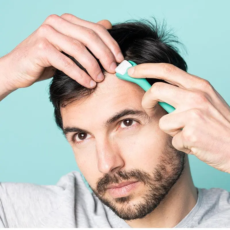 Ролик для улучшения роста волос Neofollics Hair Technology Hair Growth Enhancing Scalp Roller